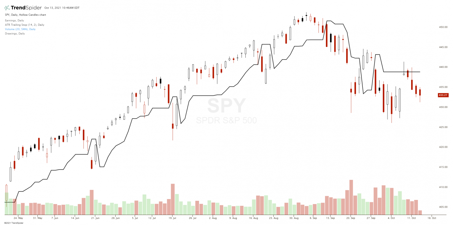 stop loss vs trailing stop loss